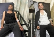 AKP’liler kavgada 3 CHP’li genci yaraladı