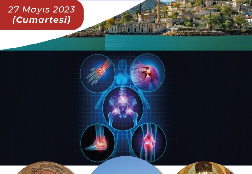 SANKO Üniversitesi Romatoloji Sempozyumu düzenleyecek