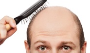 Genetik yatkınlık, saç dökülmesini tetikleyebilir