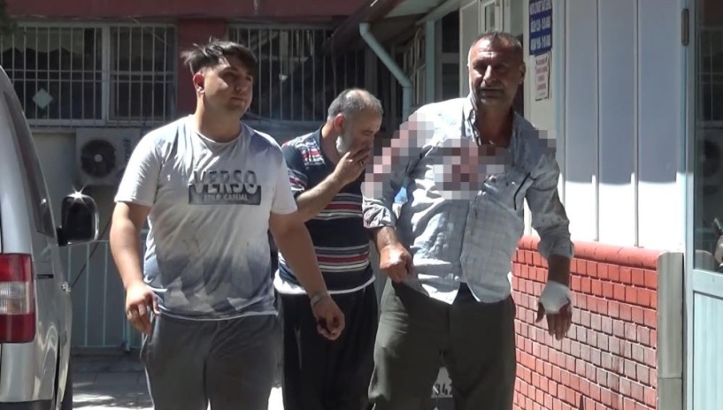 34 acemi kasap, çeşitli yerlerinden yaralandı