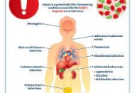 Sepsis, vücudun enfeksiyonu yenmek için verdiği yanıtın abartılı hale gelerek, organlara zarar vermesidir