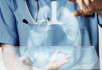 Her yıl 2 milyon kişiye akciğer kanseri teşhisi konuluyor