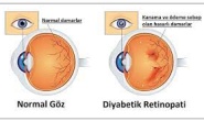 Diyabetik retinopati, körlükle sonuçlanabilir
