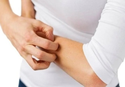 Sağlık Bakanlığı, salgın yok diyordu, ama deprem bölgesine uyuz ilacı gönderdi