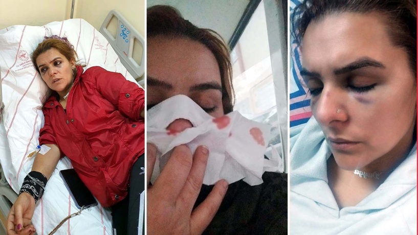 Antep'te Roman ailelerin fahri koordinatörüne saldırı