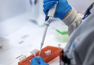 İlk kez bir kişi A(H5N2) tipi kuş gribinden öldü