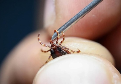 Akıllı ilaçlar, akciğer kanserinde ömrü 22 ay uzattı