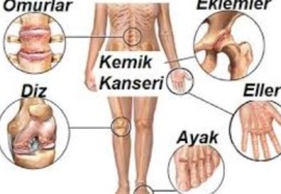 Primer kemik tümörlerinde de erken teşhis hayat kurtarır