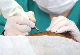 Sağlıkta kayıt dışı çalışanlar piyasanın yüzde 40'ına ulaştı