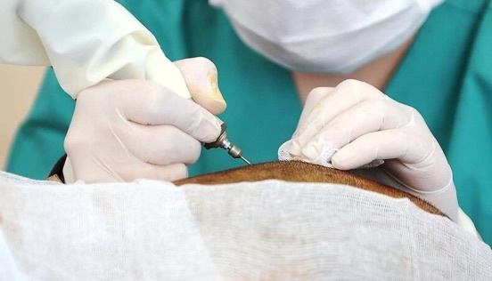 Sağlıkta kayıt dışı çalışanlar piyasanın yüzde 40'ına ulaştı