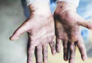 Antep’te 2 çocuk işçi yaşamını yitirdi