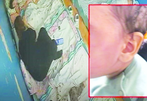 'Çocuğumun teninin hassas  olduğunu söylediler'