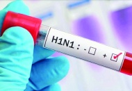 Domuz gribi olarak bilinen H1N1 virüsü salgını alarm veriyor