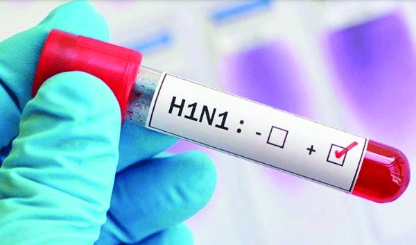 Domuz gribi olarak bilinen H1N1 virüsü salgını alarm veriyor