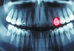 İnsanlar yeni diş çıkarabilecek