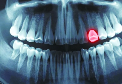 İnsanlar yeni diş çıkarabilecek