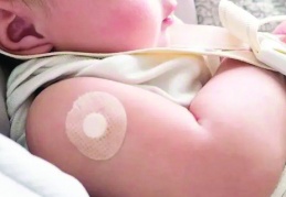 Aşı, toplum sağlığı açısından  hayati öneme sahip