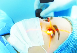 Epitel tabakası excimer lazer ile doğrudan uzaklaştırılabiliyor