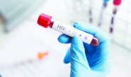 HIV vakaları son 10 yılda yüzde 460 artış gösterdi