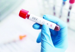 HIV vakaları son 10 yılda yüzde 460 artış gösterdi