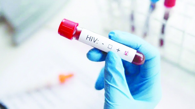 HIV vakaları son 10 yılda yüzde 460 artış gösterdi