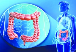 Kolorektal kanser dünya çapında en yaygın üçüncü kanser türü