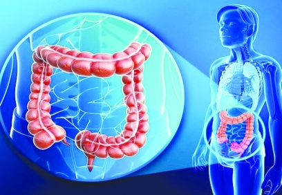 Kolorektal kanser dünya çapında en yaygın üçüncü kanser türü