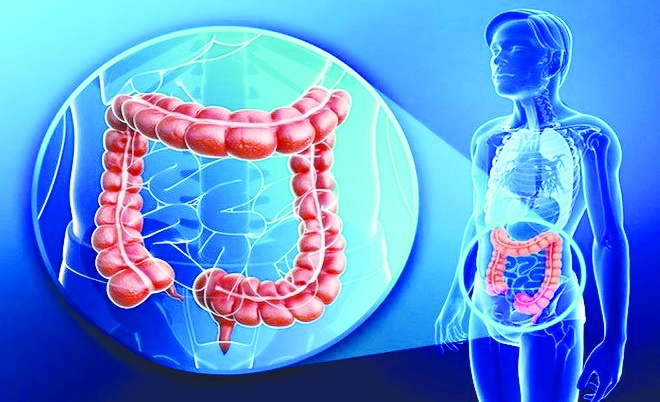 Kolorektal kanser dünya çapında en yaygın üçüncü kanser türü