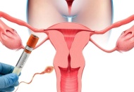 İnfertilite tedavisinde erken başvuru önemli