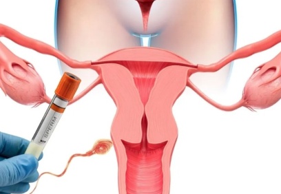 İnfertilite tedavisinde erken başvuru önemli