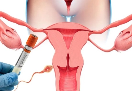 İnfertilite tedavisinde erken başvuru önemli