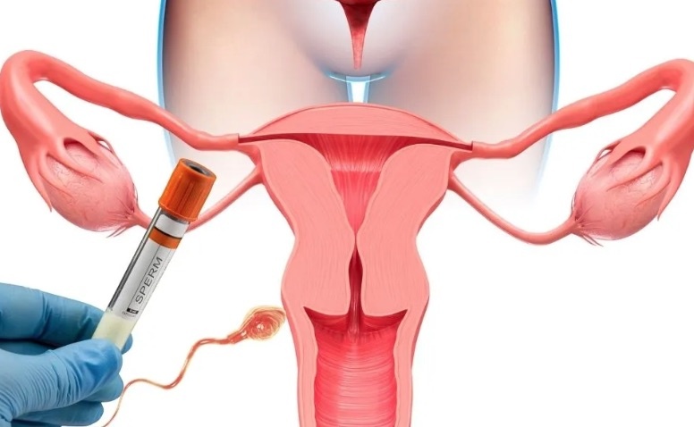 İnfertilite tedavisinde erken başvuru önemli