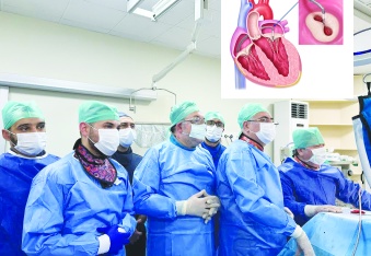 Ameliyatsız Mitral Kapak Tamiri yapıldı