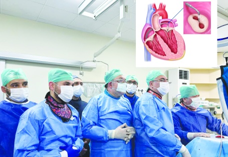Ameliyatsız Mitral Kapak Tamiri yapıldı