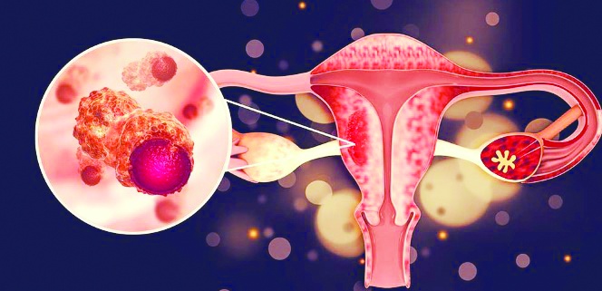 Serviks Kanseri önlenebilir bir hastalık