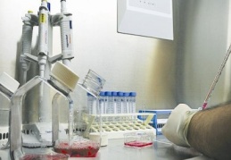 10 milyon kişinin kolesterolü yüksek