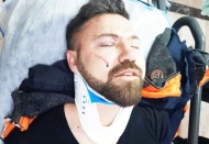 15 kişi, tek kişiye saldırdı, araya girenlere bıçak çektiler