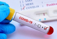 196 kişi daha hayatını kaybetti, 28 bin 370 yeni vaka tespit edildi