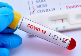 196 kişi daha hayatını kaybetti, 28 bin 370 yeni vaka tespit edildi