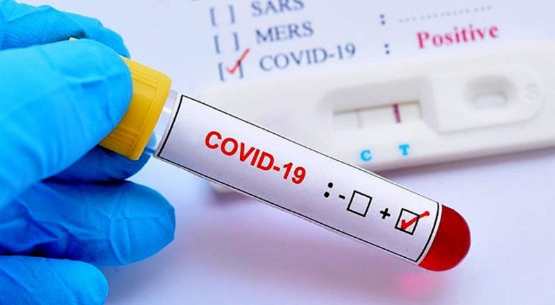 196 kişi daha hayatını kaybetti, 28 bin 370 yeni vaka tespit edildi