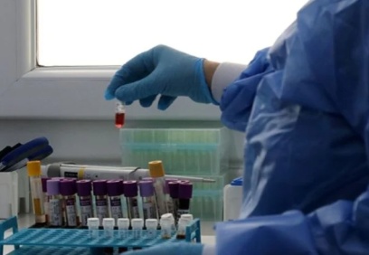 Adana Adli Tıp Kurumu Başkanı Prof. Dr. Necmi Çekin: Yakınlarını arayanlar kan örneği vermeli