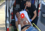 Ambulansa taşınırken armudunu yemeye devam etti