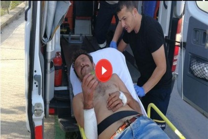Ambulansa taşınırken armudunu yemeye devam etti