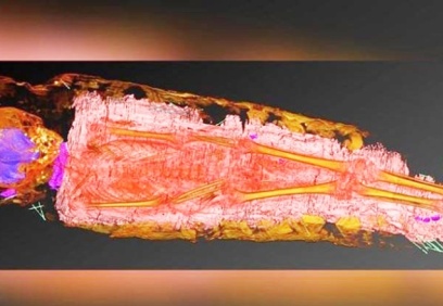 Antik Mısır mumyasını X ışınıyla tarayan bilim insanlarını şaşırtan keşif