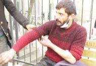 Arkadaşının evine hurda toplama aleti almaya gitti, pitbull saldırısına uğradı