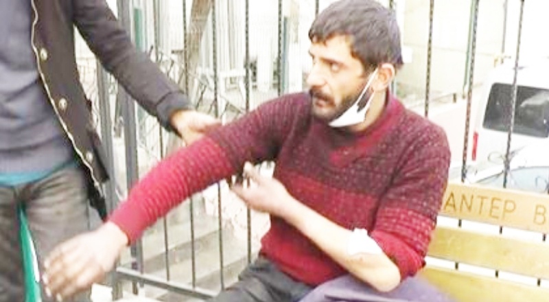 Arkadaşının evine hurda toplama aleti almaya gitti, pitbull saldırısına uğradı