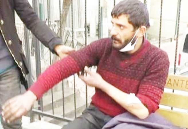 Arkadaşının evine hurda toplama aleti almaya gitti, pitbull saldırısına uğradı