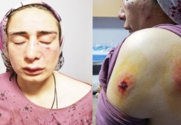 'Bekle, bu sefer gelip seni öldüreceğim' diyerek gitti
