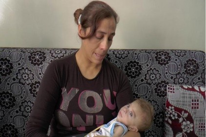 Berat&#8217;ın yaşam mücadelesi doğuştan başladı