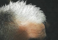 Beyaz saç hastalık habercisi olabilir